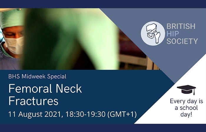 Midweek Special - Femoral Neck Fractures