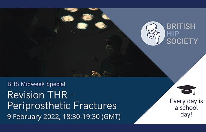 Midweek Special - Revision THR - Periprosthetic Fractures