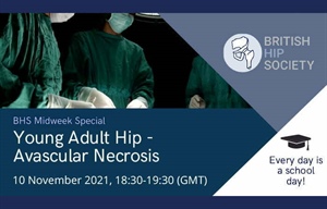 Young Adult Hip - Avascular Necrosis